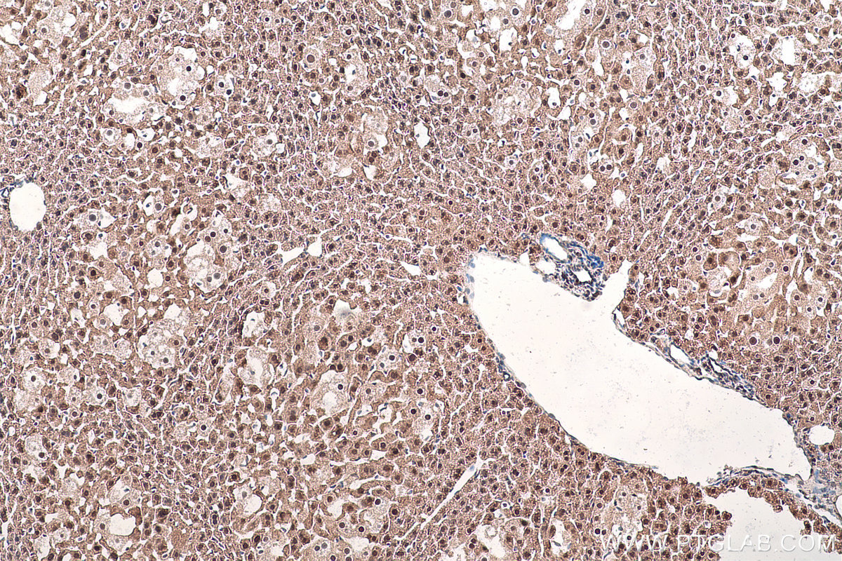 Immunohistochemical analysis of paraffin-embedded mouse liver tissue slide using KHC0921 (COPS5/JAB1 IHC Kit).