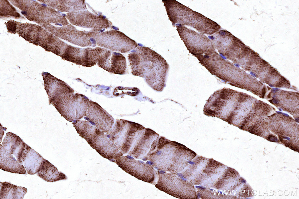 Immunohistochemical analysis of paraffin-embedded mouse skeletal muscle tissue slide using KHC3176 (COX5B IHC Kit).