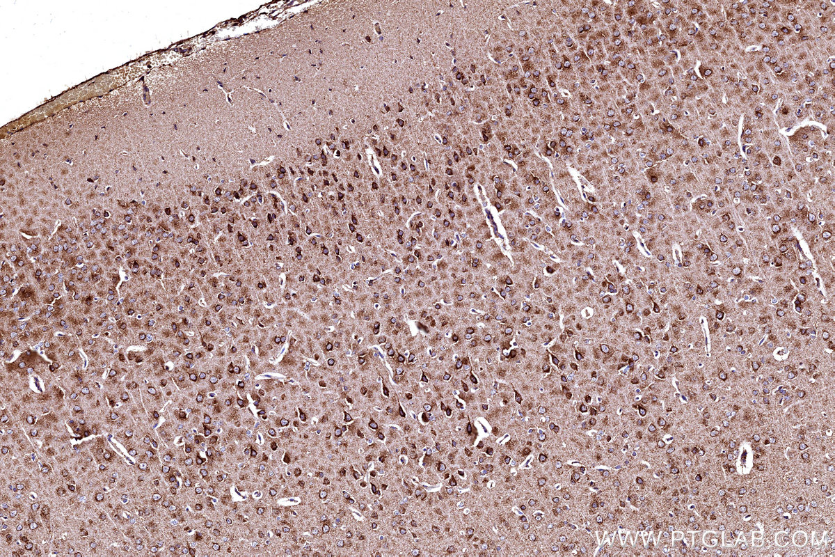 Immunohistochemical analysis of paraffin-embedded rat brain tissue slide using KHC3176 (COX5B IHC Kit).