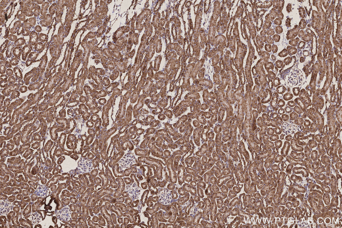 Immunohistochemical analysis of paraffin-embedded mouse kidney tissue slide using KHC3179 (COX6A1 IHC Kit).