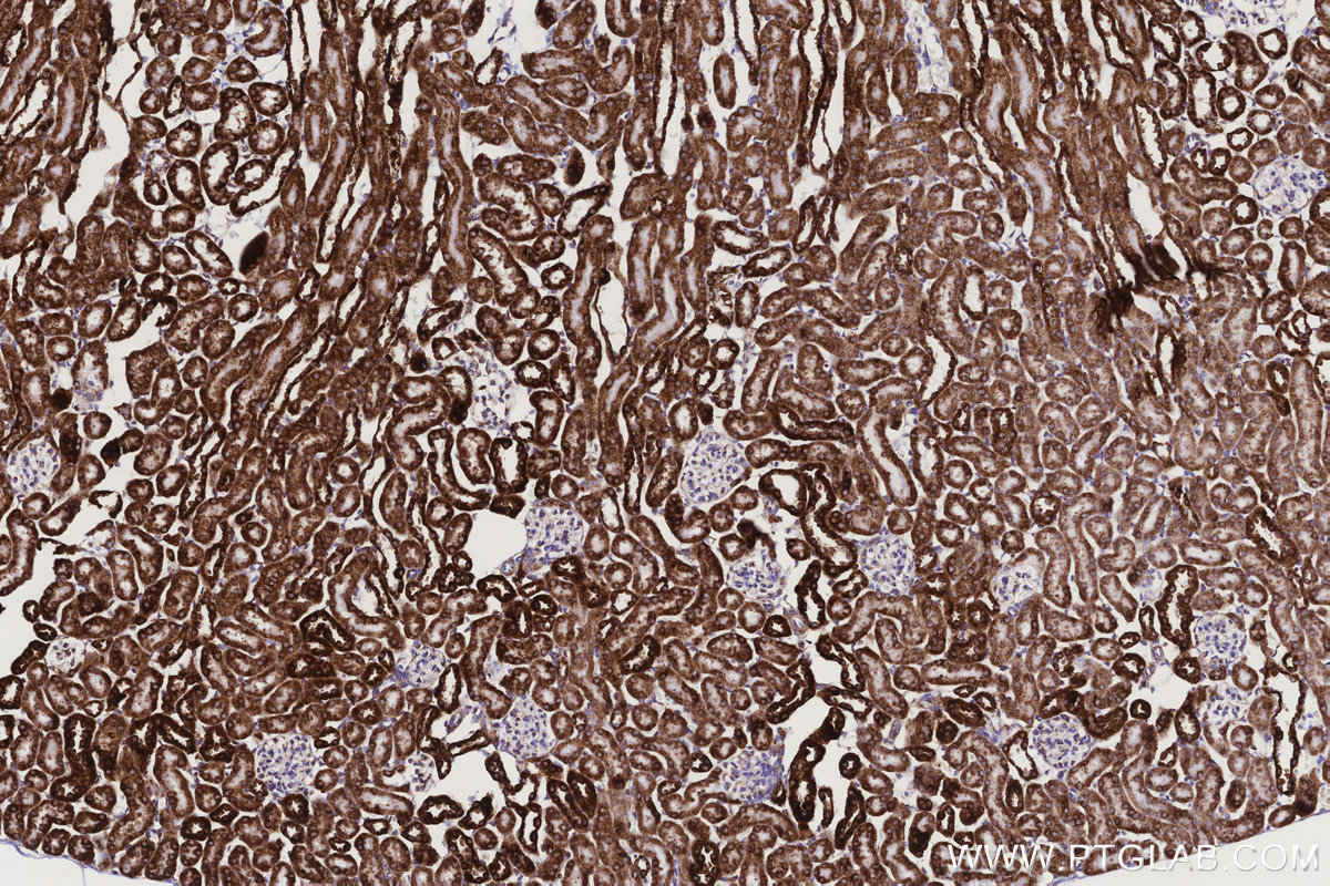 Immunohistochemical analysis of paraffin-embedded mouse kidney tissue slide using KHC3173 (COX6C IHC Kit). Immunohistochemical analysis of paraffin-embedded mouse kidney tissue slide using KHC3173 (COX6C IHC Kit).