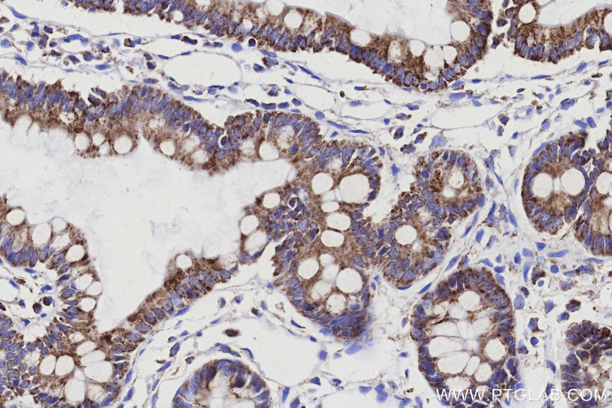 Immunohistochemical analysis of paraffin-embedded rat small intestine tissue slide using KHC3173 (COX6C IHC Kit). Immunohistochemical analysis of paraffin-embedded rat small intestine tissue slide using KHC3173 (COX6C IHC Kit).