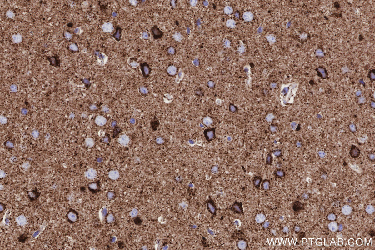 Immunohistochemical analysis of paraffin-embedded mouse brain tissue slide using KHC3182 (COXIV IHC Kit).