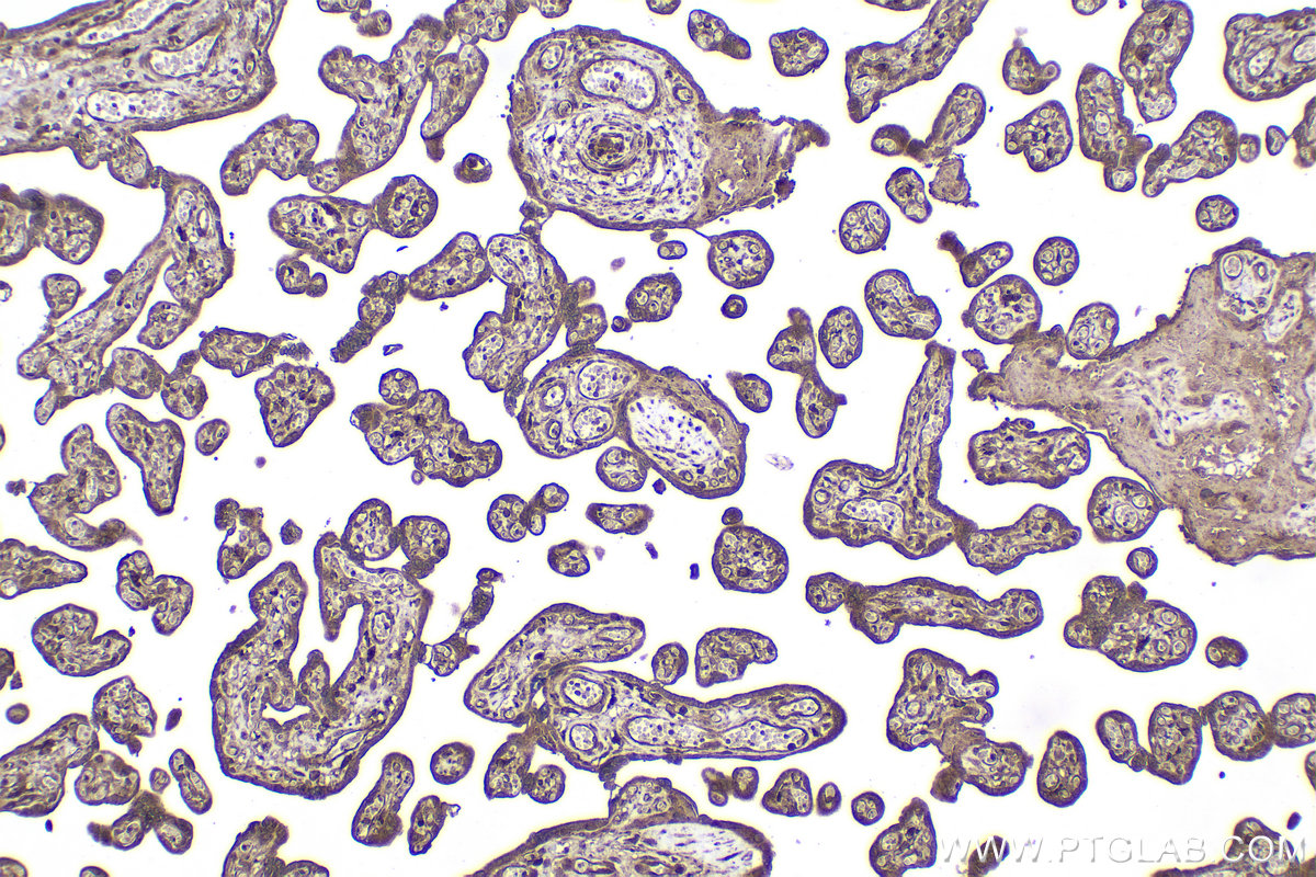 Immunohistochemical analysis of paraffin-embedded human placenta tissue slide using KHC2079 (CP110 IHC Kit).