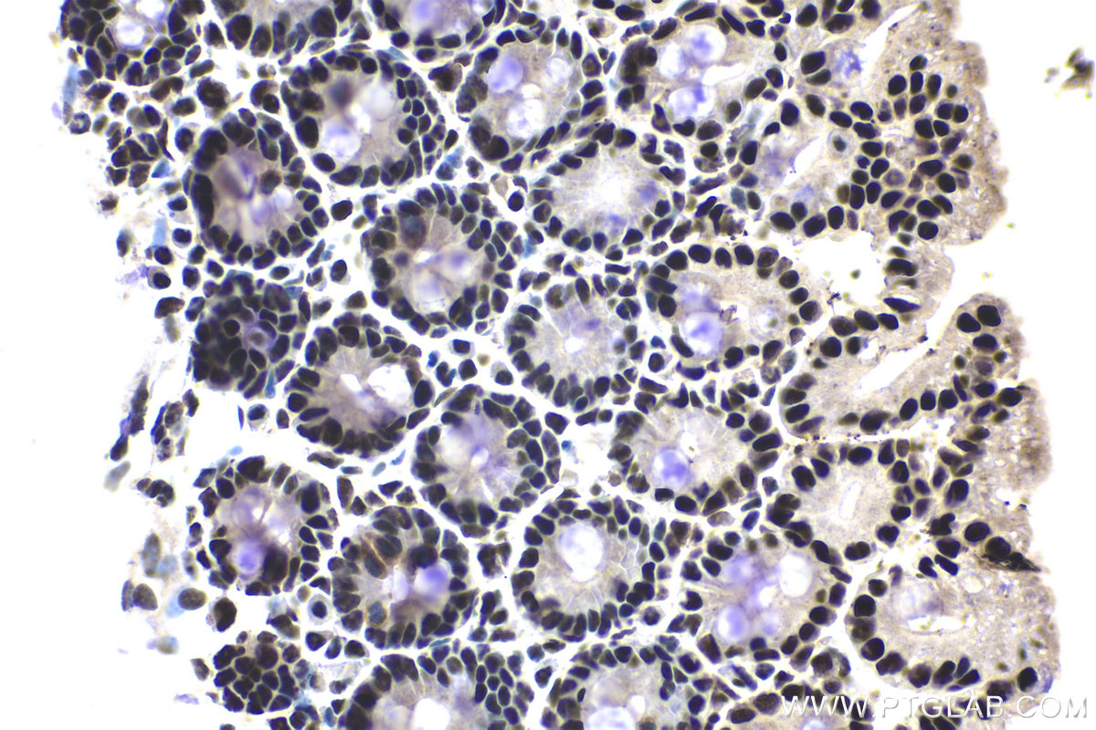 Immunohistochemical analysis of paraffin-embedded mouse intestine tissue slide using KHC1974 (CPSF2 IHC Kit).