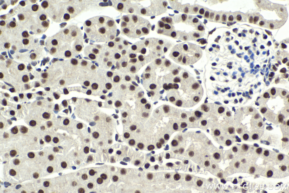 Immunohistochemical analysis of paraffin-embedded mouse kidney tissue slide using KHC1991 (CPSF3 IHC Kit).