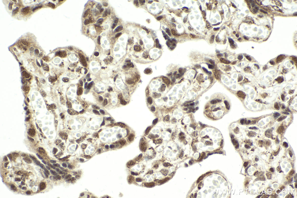 Immunohistochemical analysis of paraffin-embedded human placenta tissue slide using KHC1991 (CPSF3 IHC Kit).