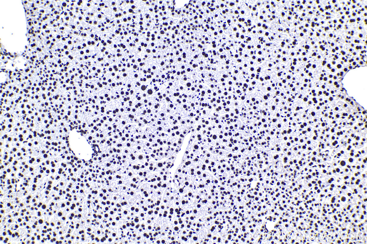 Immunohistochemical analysis of paraffin-embedded mouse liver tissue slide using KHC1388 (CPSF6 IHC Kit).