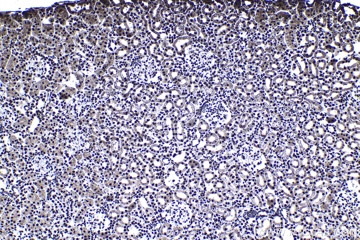 Immunohistochemical analysis of paraffin-embedded rat kidney tissue slide using KHC1388 (CPSF6 IHC Kit).