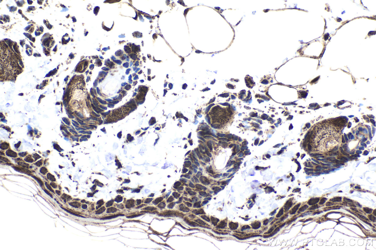 Immunohistochemical analysis of paraffin-embedded rat skin tissue slide using KHC1833 (CPSF7 IHC Kit).