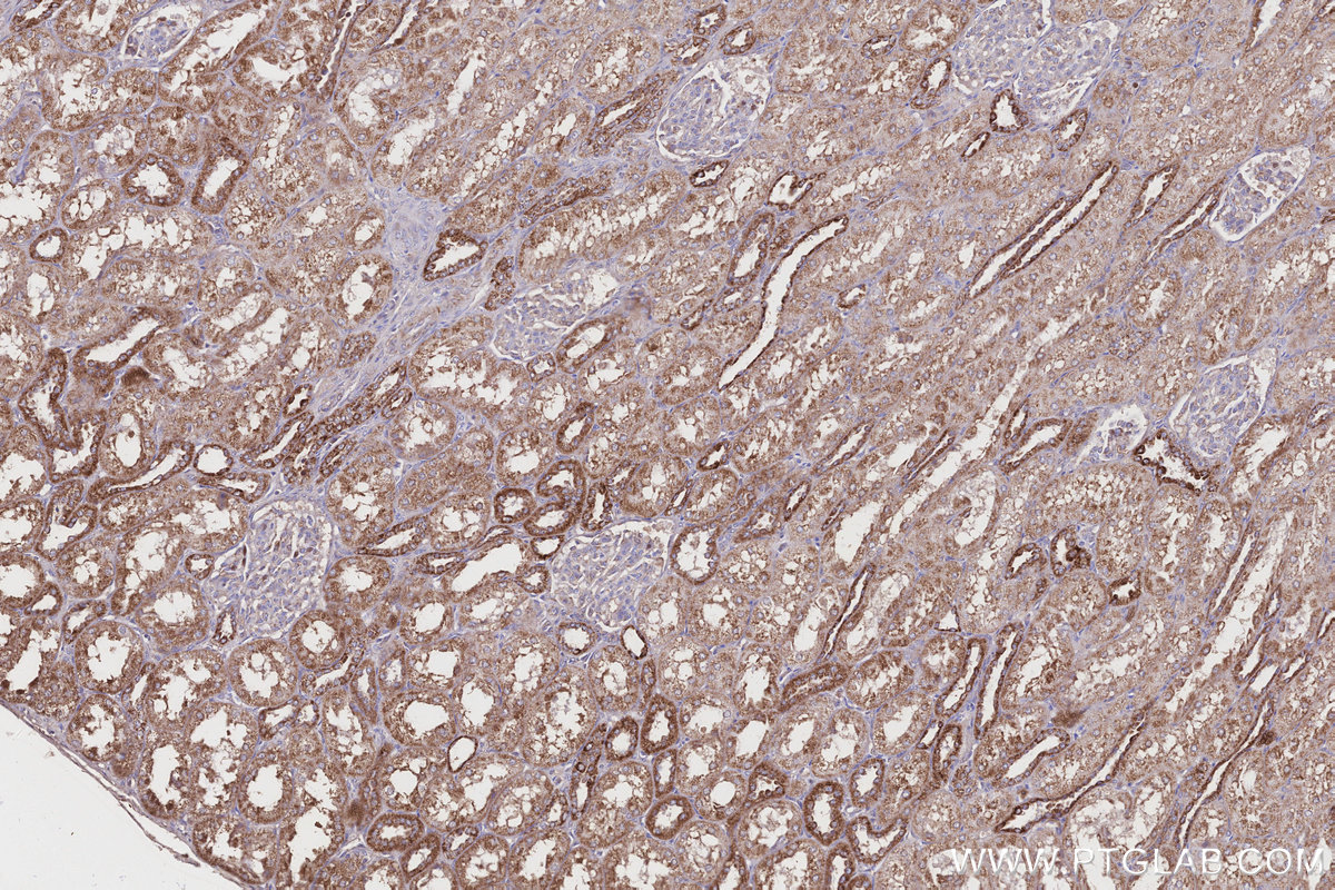 Immunohistochemical analysis of paraffin-embedded human kidney tissue slide using KHC0332 (CPT1A IHC Kit).