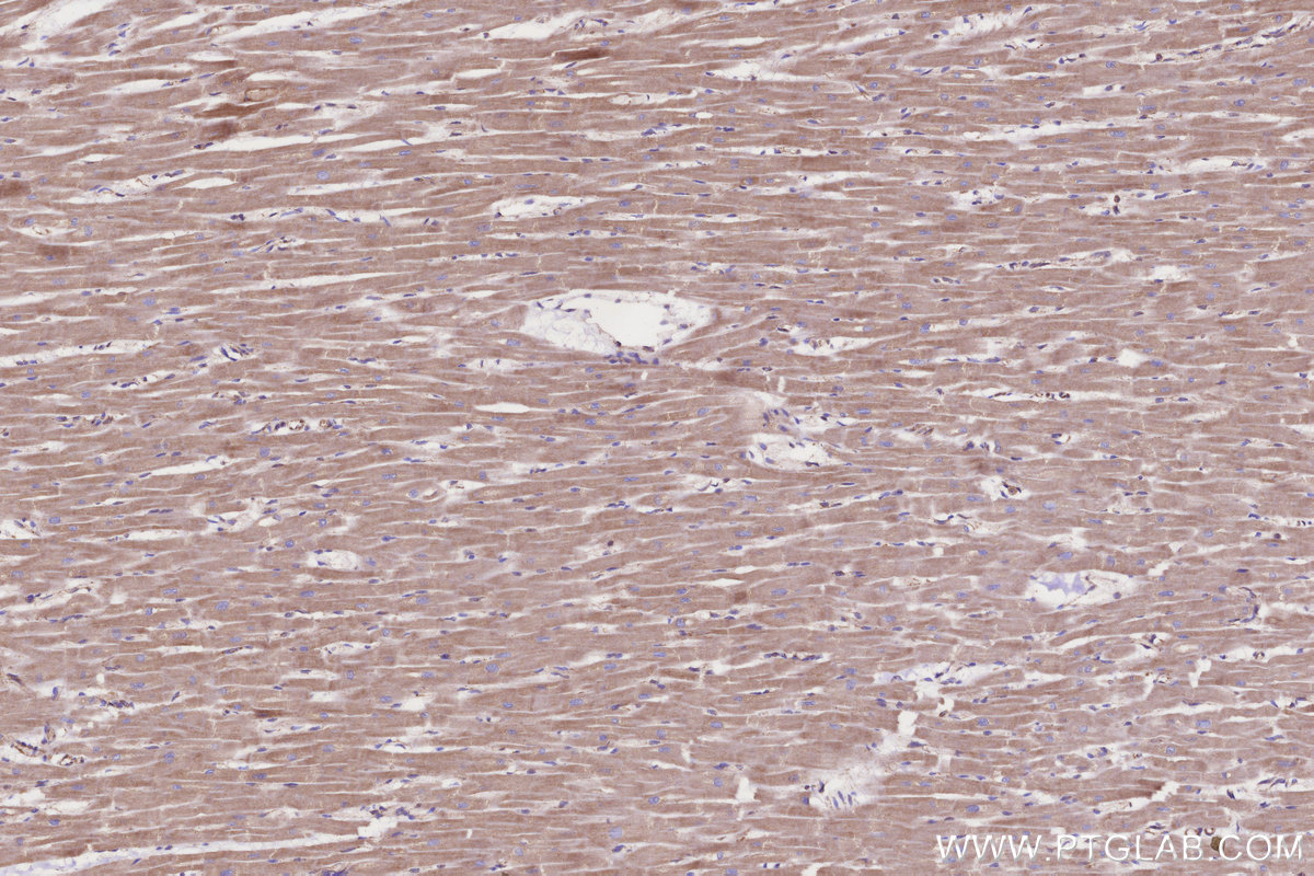 Immunohistochemical analysis of paraffin-embedded human heart tissue slide using KHC0332 (CPT1A IHC Kit).