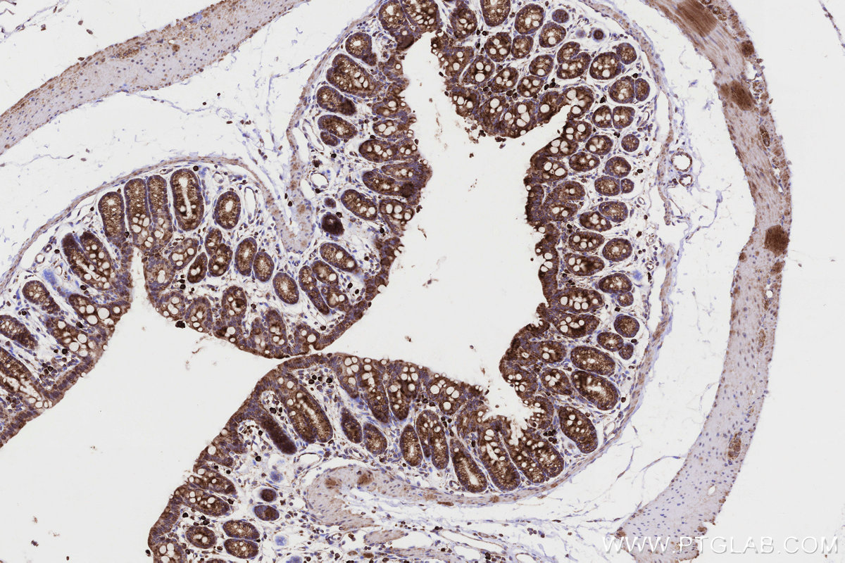 Immunohistochemical analysis of paraffin-embedded mouse colon tissue slide using KHC0332 (CPT1A IHC Kit).