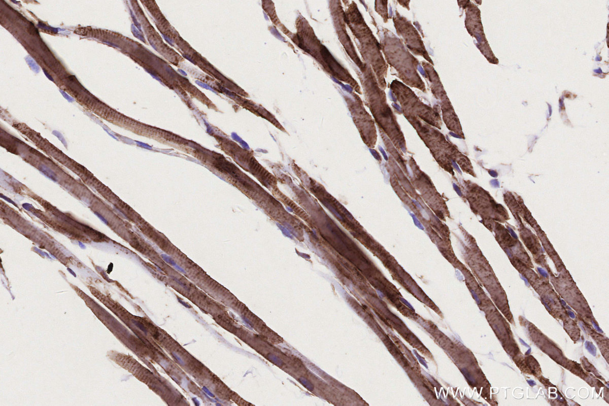 Immunohistochemical analysis of paraffin-embedded mouse heart tissue slide using KHC0332 (CPT1A IHC Kit).