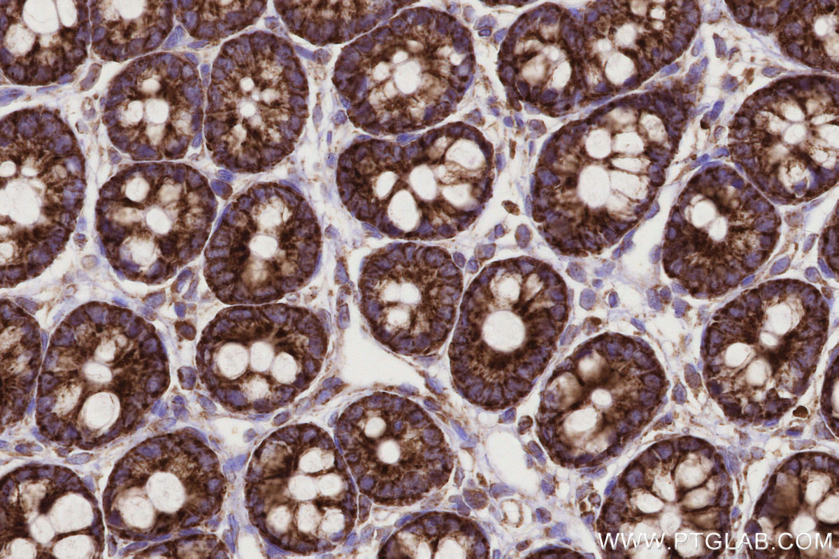 Immunohistochemical analysis of paraffin-embedded rat colon tissue slide using KHC0332 (CPT1A IHC Kit).