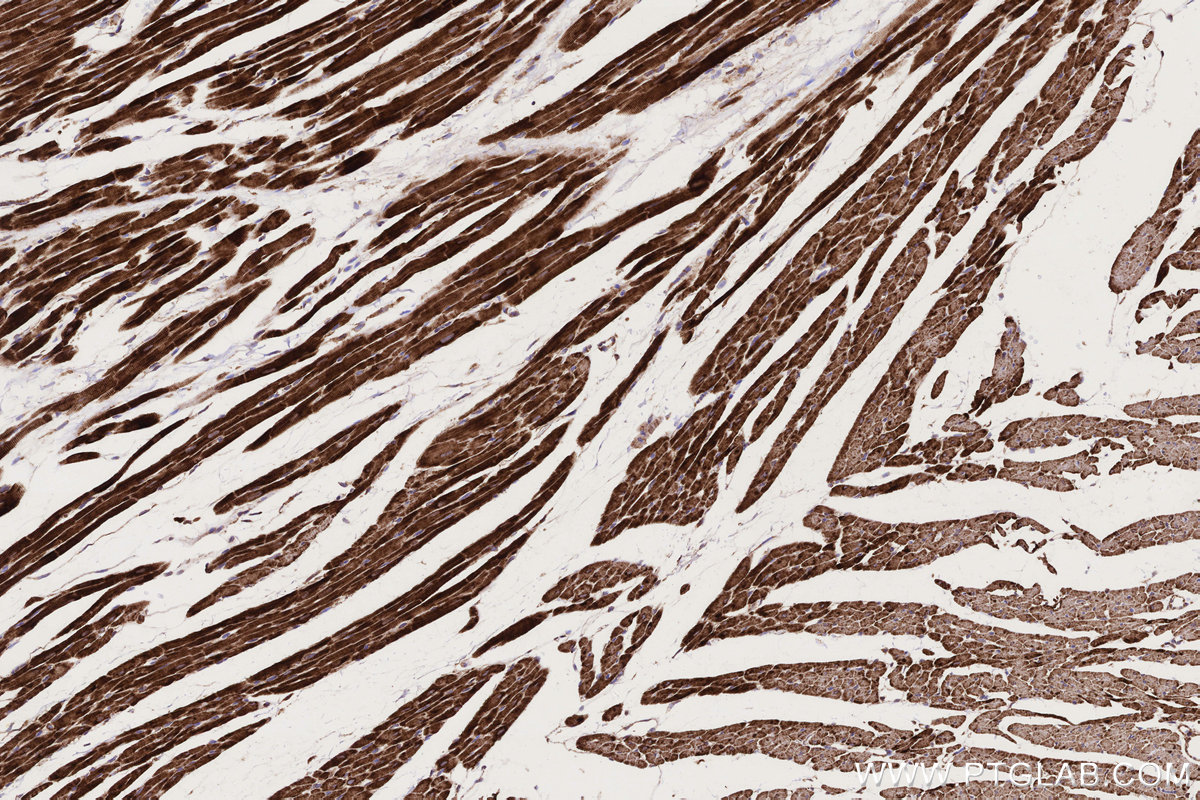 Immunohistochemical analysis of paraffin-embedded rat heart tissue slide using KHC0332 (CPT1A IHC Kit).