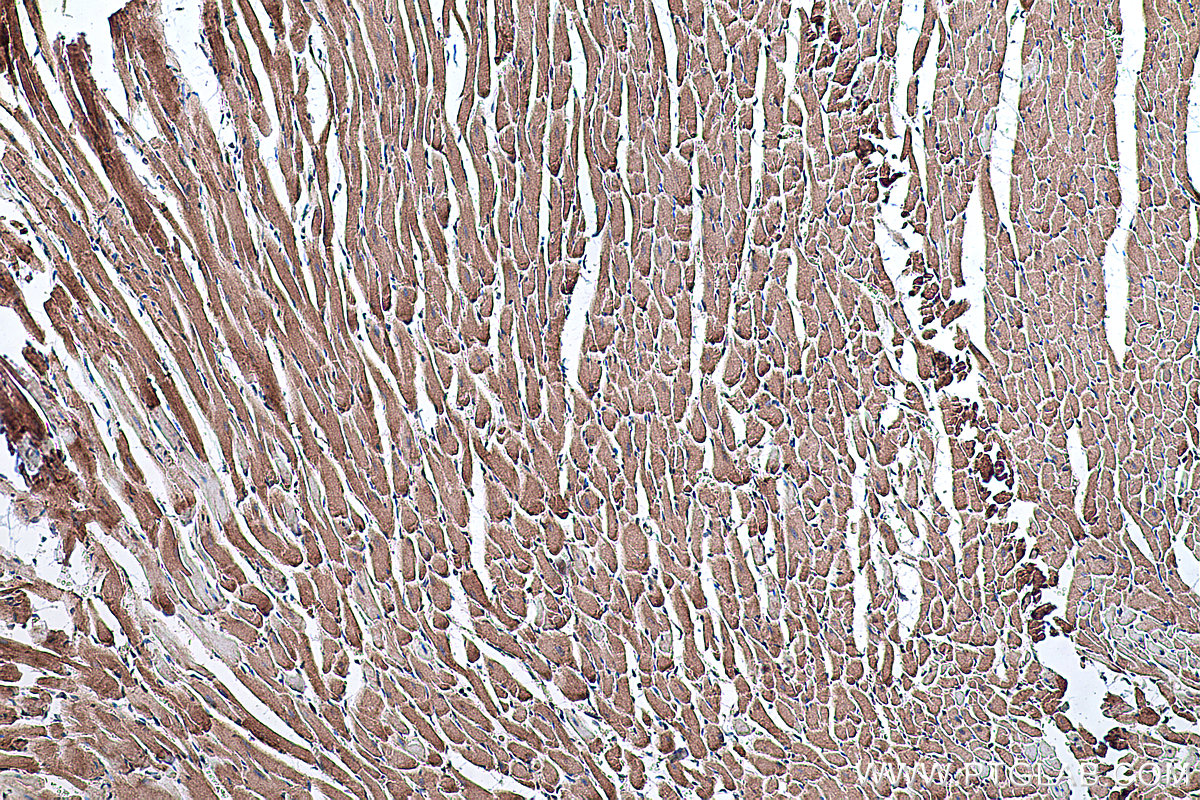 Immunohistochemical analysis of paraffin-embedded rat heart tissue slide using KHC0334 (CPT2 IHC Kit).