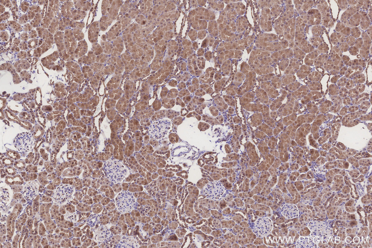 Immunohistochemical analysis of paraffin-embedded rat kidney tissue slide using KHC3263 (CPTP IHC Kit).