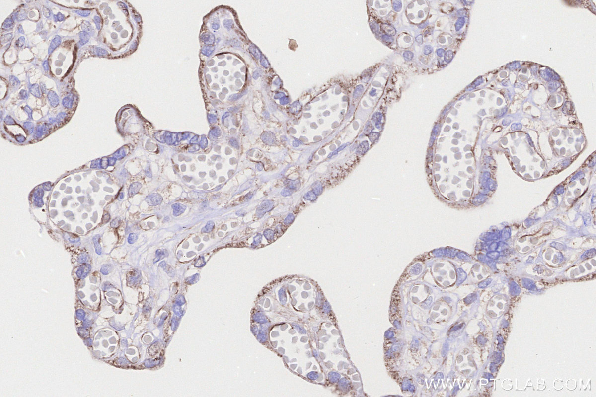 Immunohistochemical analysis of paraffin-embedded human placenta tissue slide using KHC3263 (CPTP IHC Kit).