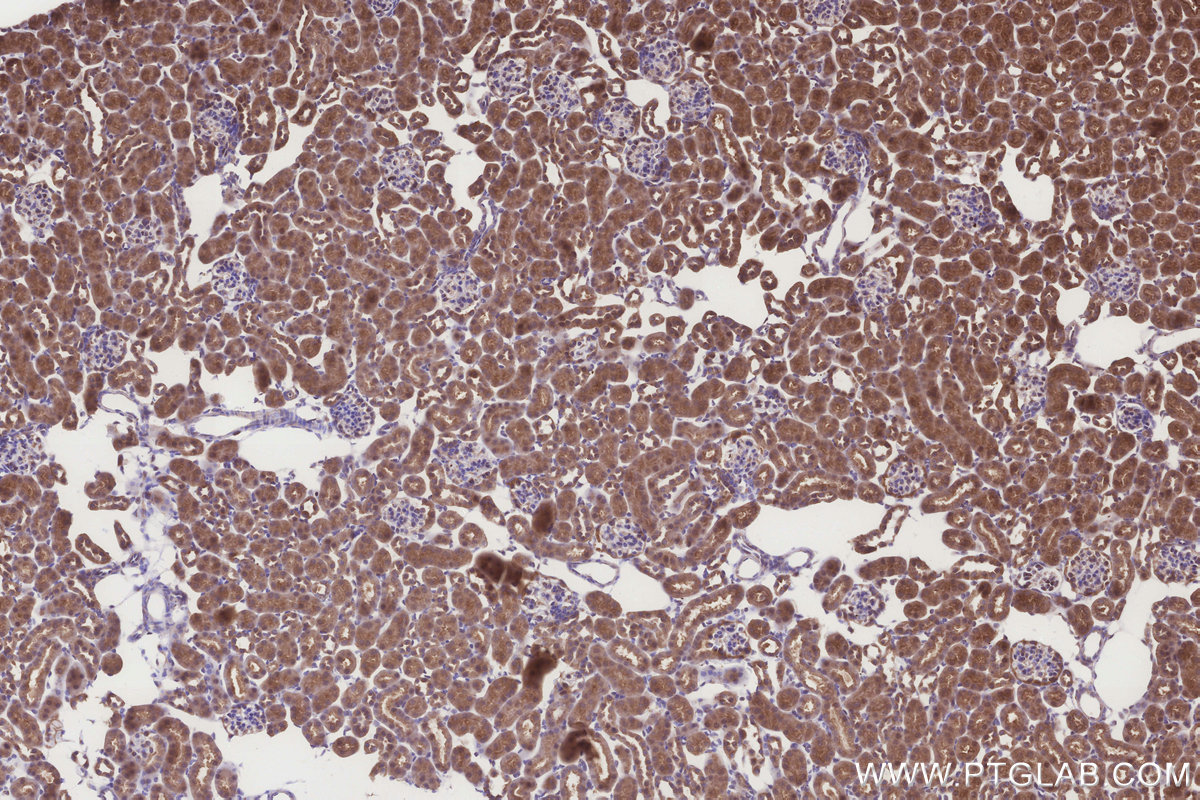 Immunohistochemical analysis of paraffin-embedded mouse kidney tissue slide using KHC3263 (CPTP IHC Kit).