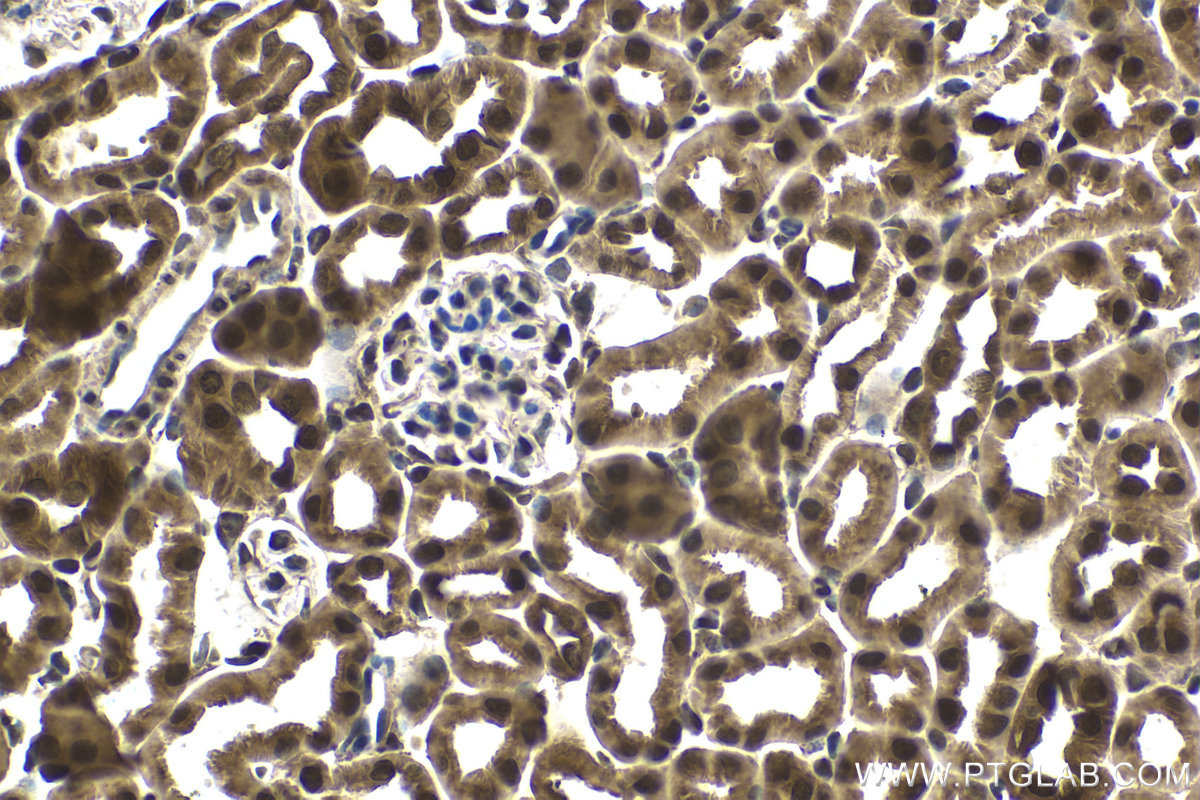 Immunohistochemical analysis of paraffin-embedded mouse kidney tissue slide using KHC1654 (CRADD IHC Kit).