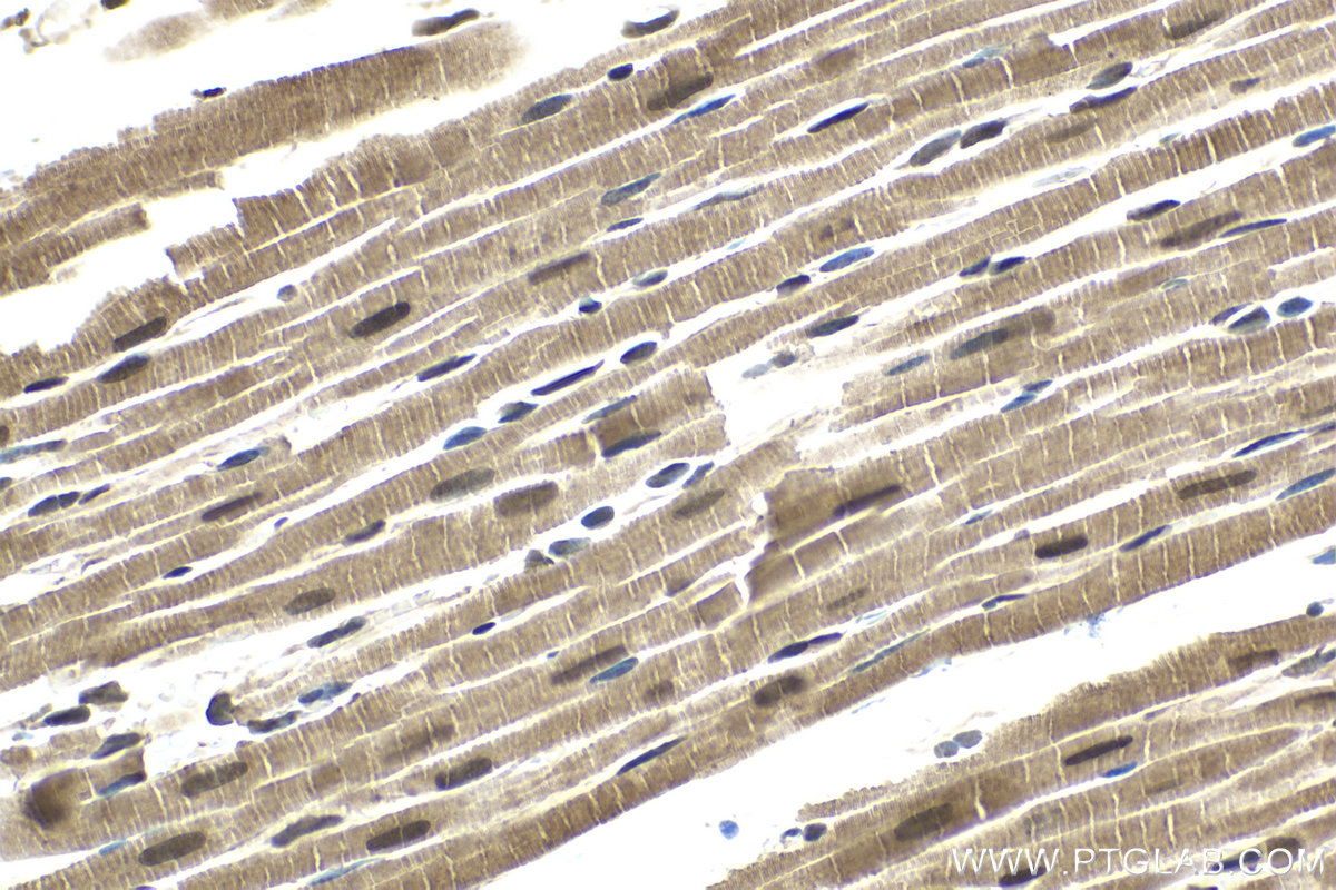 Immunohistochemical analysis of paraffin-embedded rat heart tissue slide using KHC1654 (CRADD IHC Kit).