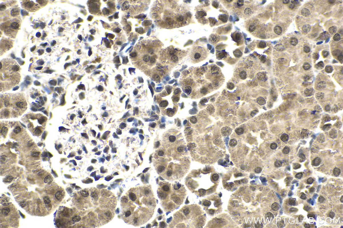 Immunohistochemical analysis of paraffin-embedded rat kidney tissue slide using KHC1654 (CRADD IHC Kit).