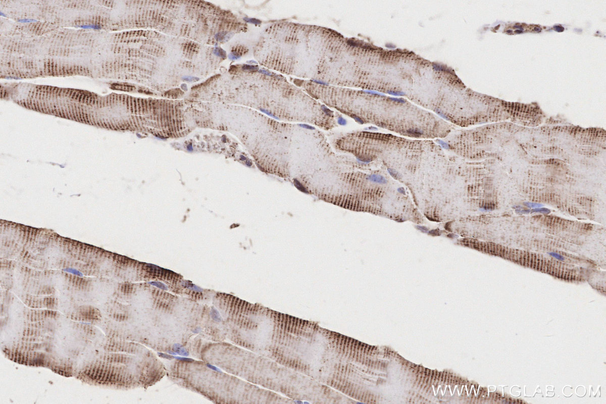 Immunohistochemical analysis of paraffin-embedded mouse skeletal muscle tissue slide using KHC3209 (CRAT IHC Kit).