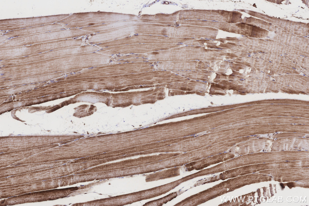 Immunohistochemical analysis of paraffin-embedded rat skeletal muscle tissue slide using KHC3209 (CRAT IHC Kit).
