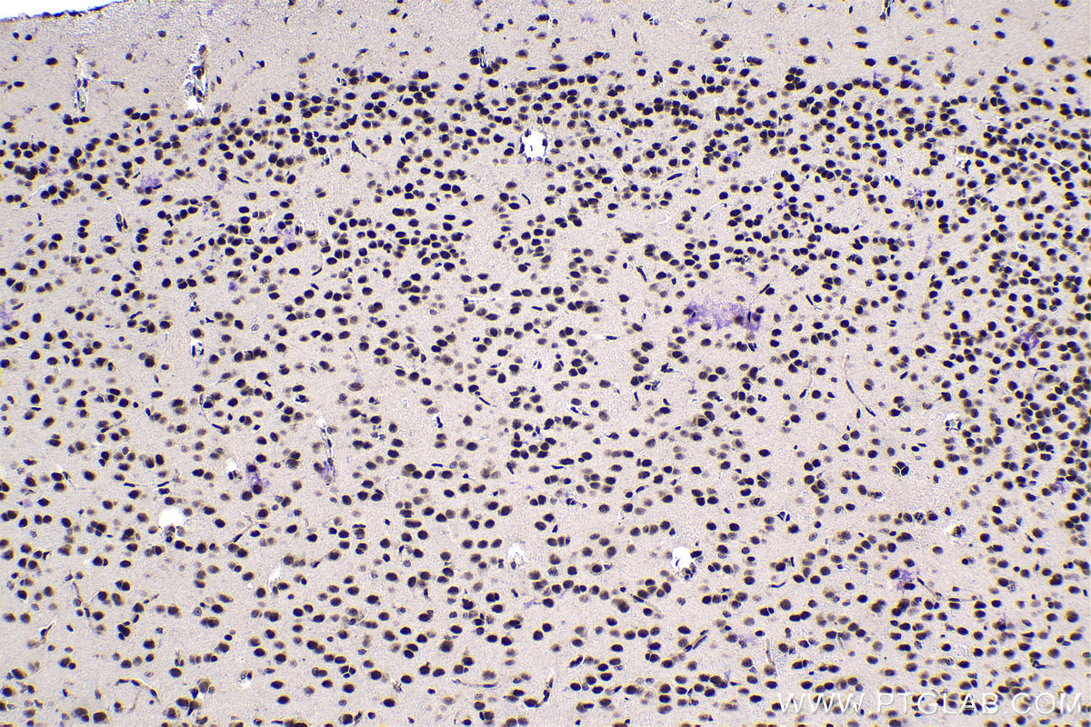 Immunohistochemical analysis of paraffin-embedded rat brain tissue slide using KHC1124 (CREB1 IHC Kit).