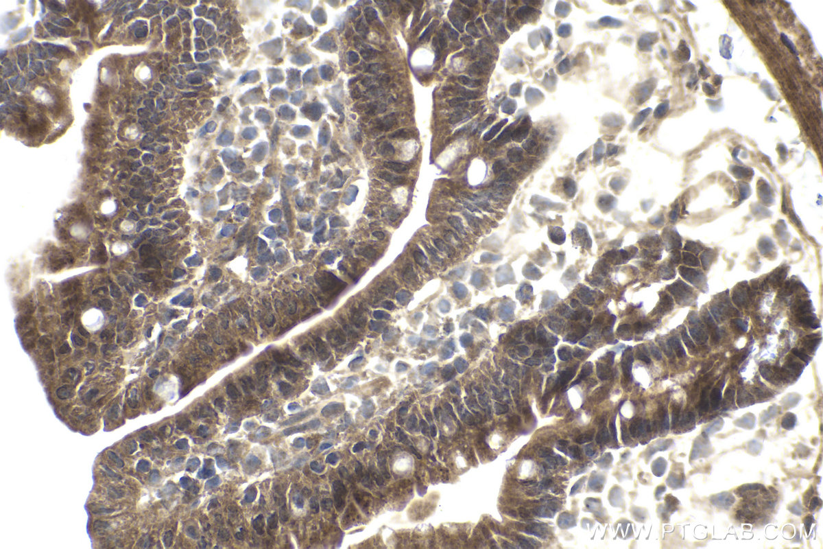 Immunohistochemical analysis of paraffin-embedded mouse small intestine tissue slide using KHC1795 (CREB3L2 IHC Kit).
