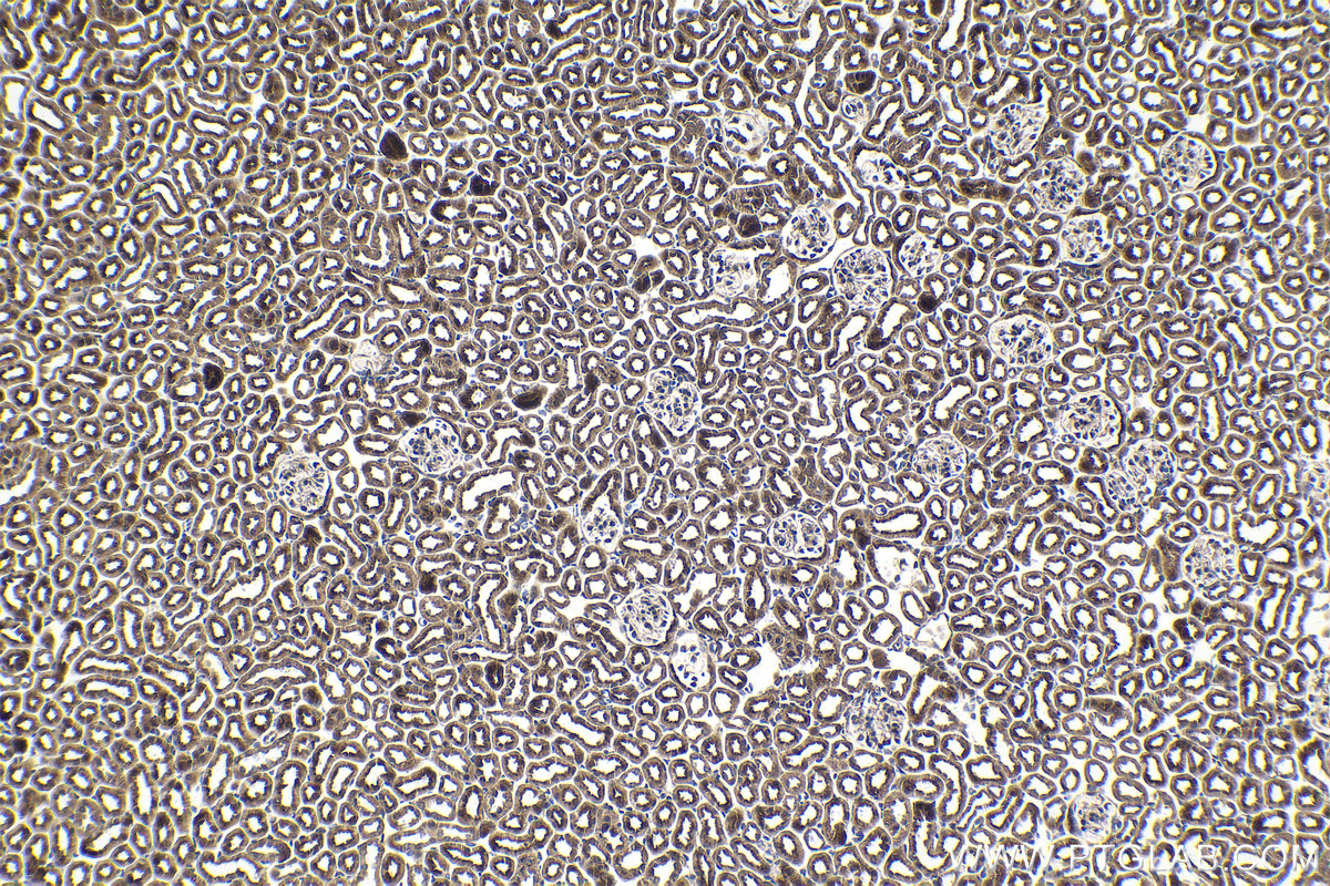 Immunohistochemical analysis of paraffin-embedded mouse kidney tissue slide using KHC1795 (CREB3L2 IHC Kit).