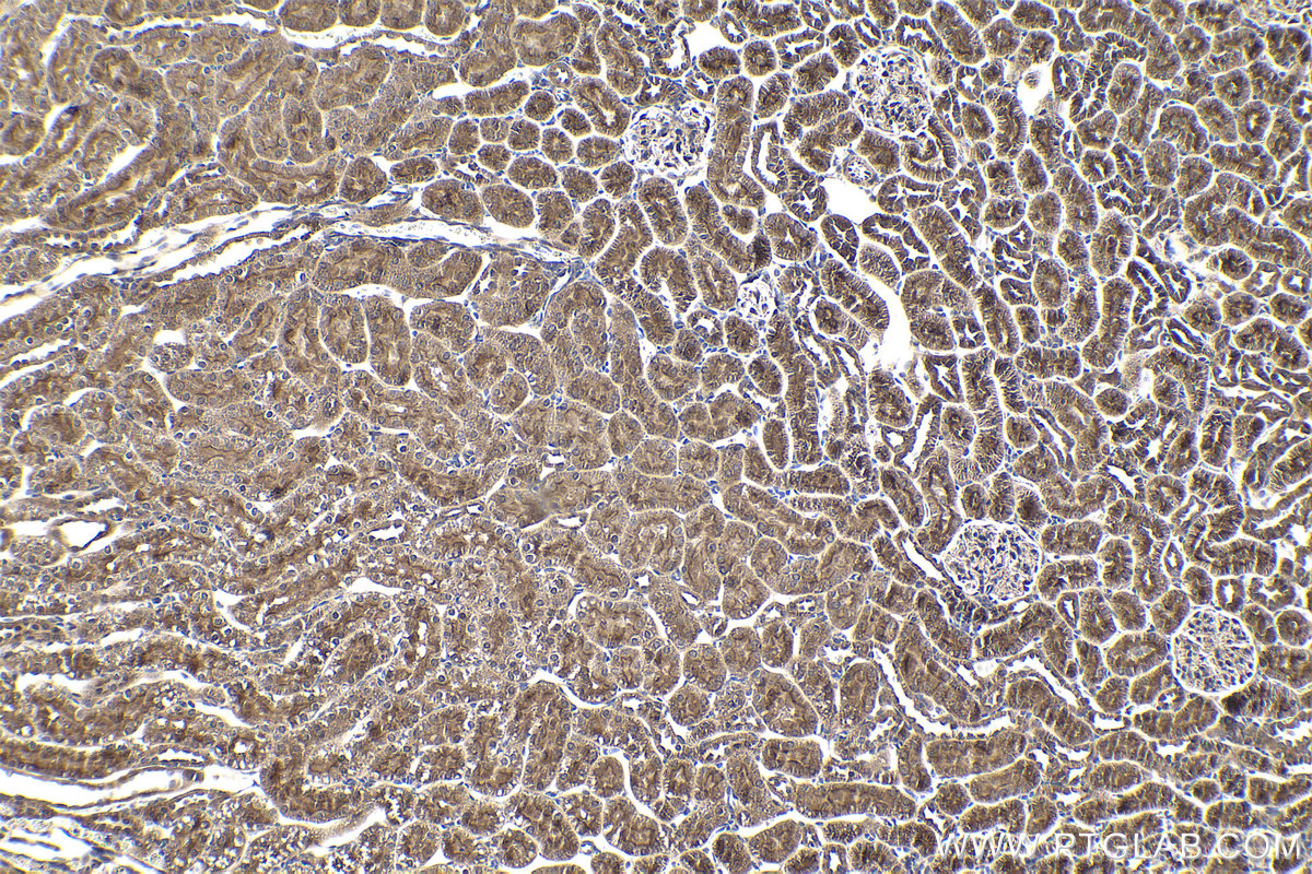 Immunohistochemical analysis of paraffin-embedded rat kidney tissue slide using KHC1795 (CREB3L2 IHC Kit).