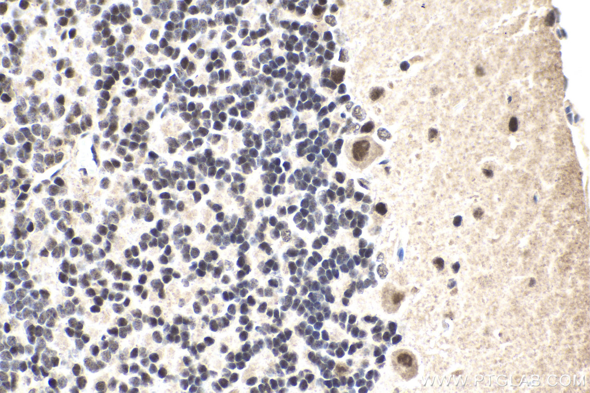 Immunohistochemical analysis of paraffin-embedded rat cerebellum tissue slide using KHC1856 (CREBBP IHC Kit).