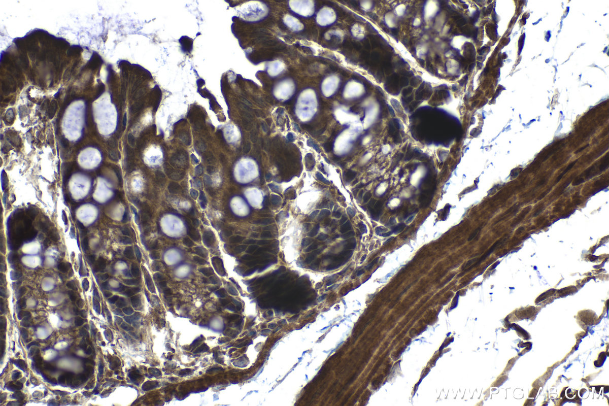 Immunohistochemical analysis of paraffin-embedded mouse colon tissue slide using KHC1111 (CRISP3 IHC Kit).