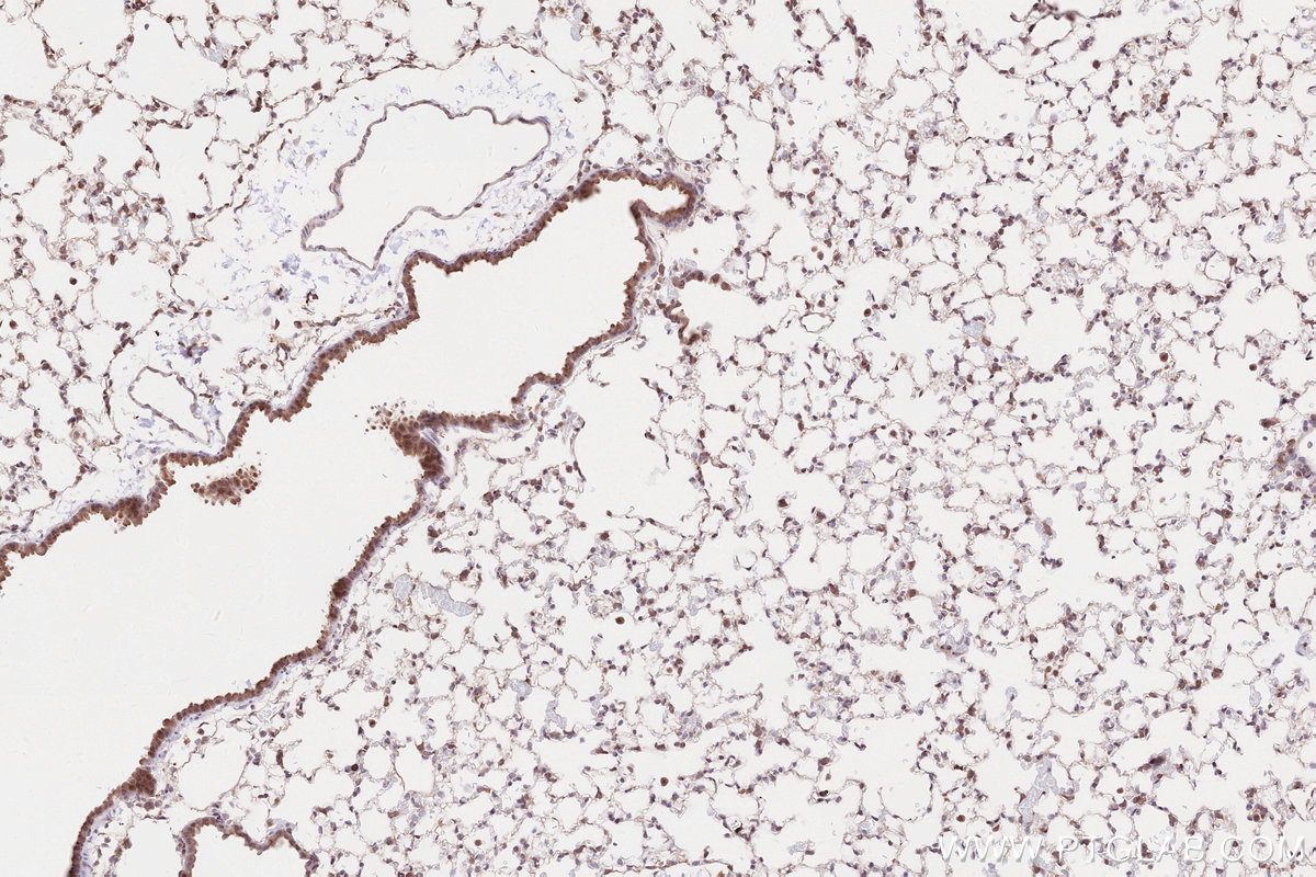 Immunohistochemical analysis of paraffin-embedded mouse lung tissue slide using KHC2559 (CROCC/Rootletin IHC Kit).