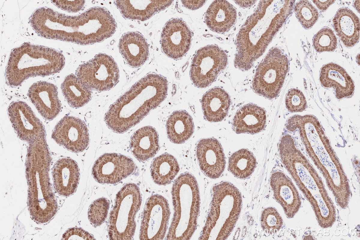 Immunohistochemical analysis of paraffin-embedded mouse epididymis tissue slide using KHC2559 (CROCC/Rootletin IHC Kit).