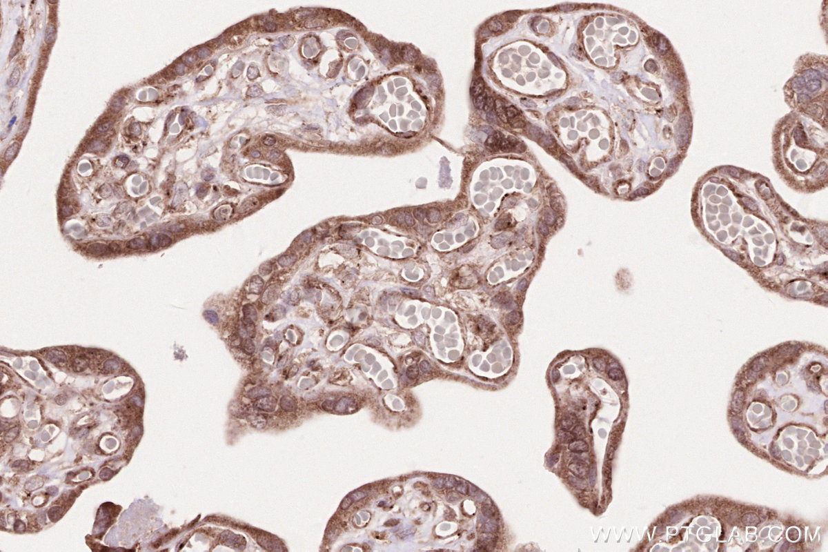 Immunohistochemical analysis of paraffin-embedded human placenta tissue slide using KHC2559 (CROCC/Rootletin IHC Kit).