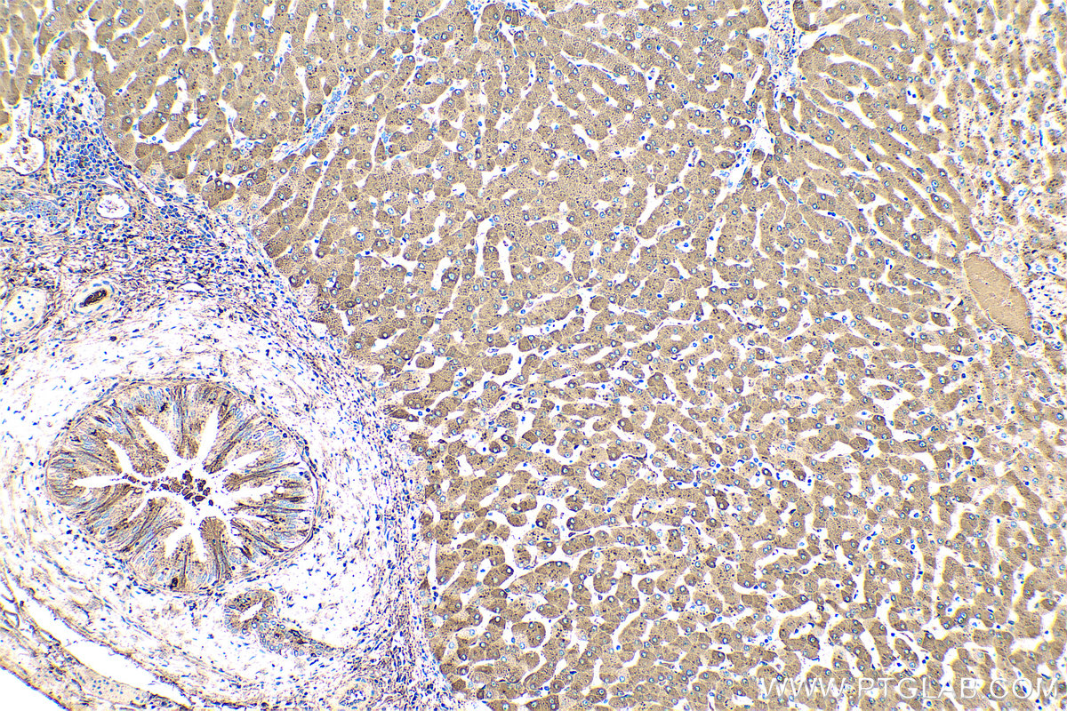 Immunohistochemical analysis of paraffin-embedded human liver tissue slide using KHC0397 (CRP IHC Kit).