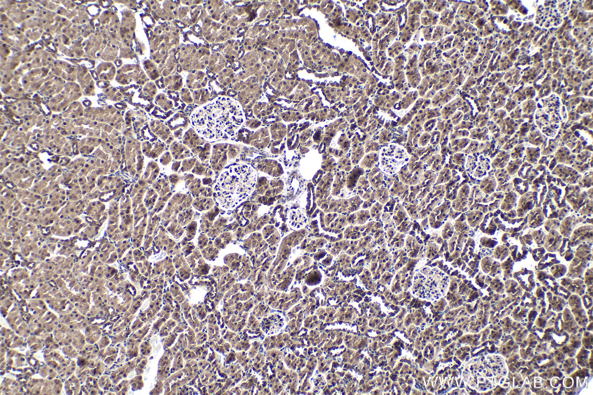 Immunohistochemical analysis of paraffin-embedded rat kidney tissue slide using KHC1784 (CRTC2 IHC Kit).