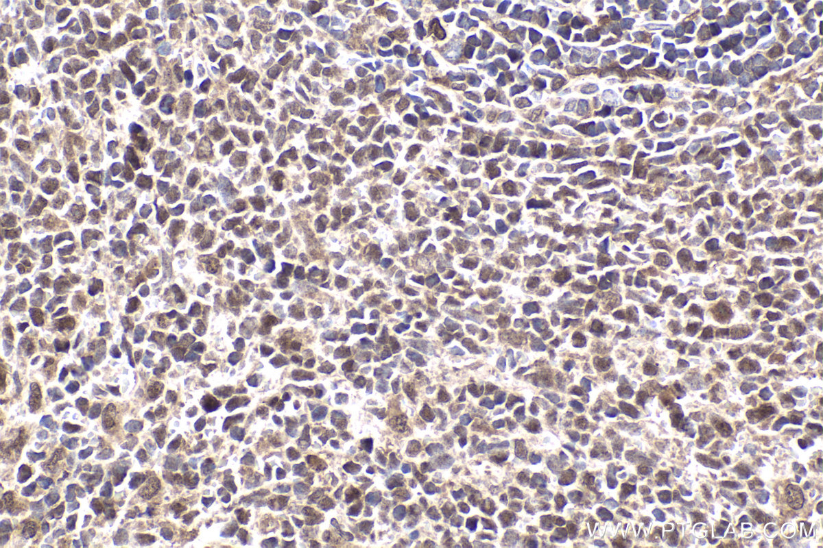 Immunohistochemical analysis of paraffin-embedded rat spleen tissue slide using KHC1784 (CRTC2 IHC Kit).