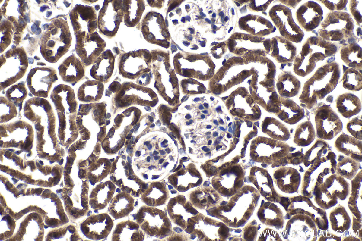 Immunohistochemical analysis of paraffin-embedded mouse kidney tissue slide using KHC1784 (CRTC2 IHC Kit).