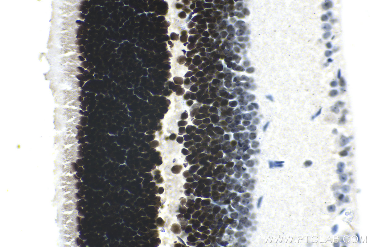 Immunohistochemical analysis of paraffin-embedded mouse eye tissue slide using KHC1449 (CRX IHC Kit).