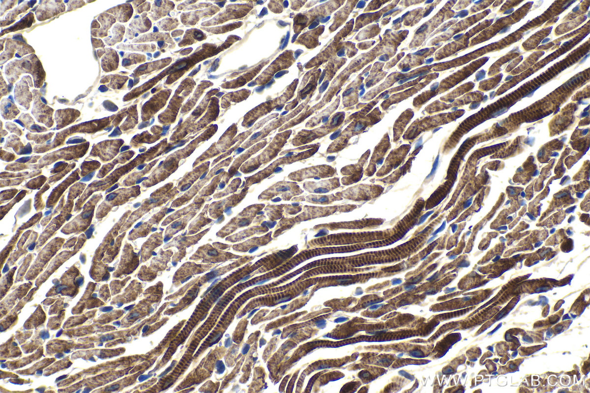 Immunohistochemical analysis of paraffin-embedded mouse heart tissue slide using KHC1503 (CRYAB IHC Kit).