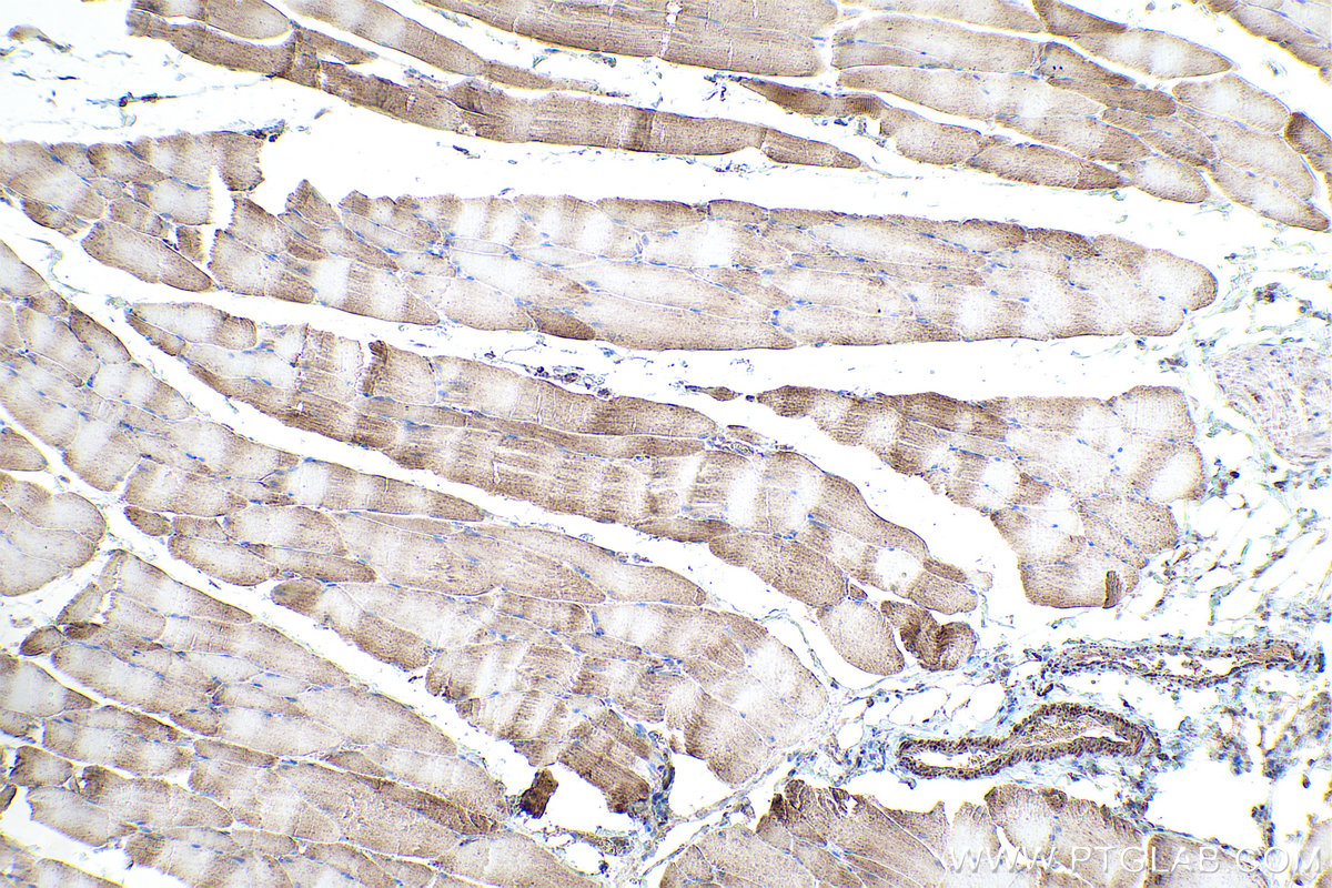 Immunohistochemical analysis of paraffin-embedded rat skeletal muscle tissue slide using KHC0877 (CS IHC Kit).