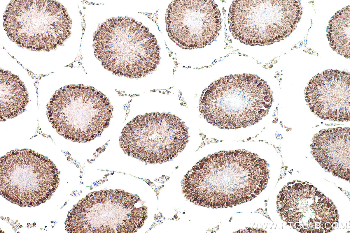 Immunohistochemical analysis of paraffin-embedded rat testis tissue slide using KHC0779 (CSE1L IHC Kit).