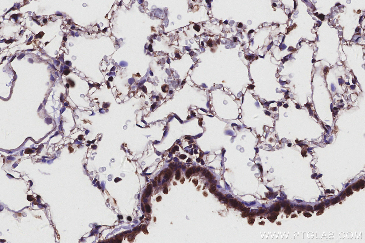 Immunohistochemical analysis of paraffin-embedded rat lung tissue slide using KHC2932 (CSNK1G1 IHC Kit).
