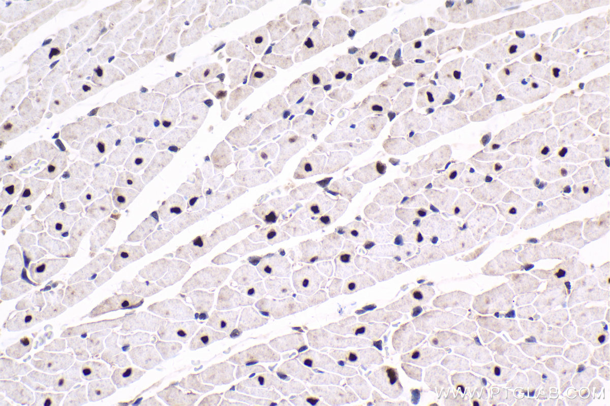 Immunohistochemical analysis of paraffin-embedded rat heart tissue slide using KHC1651 (CSNK2A1 IHC Kit).