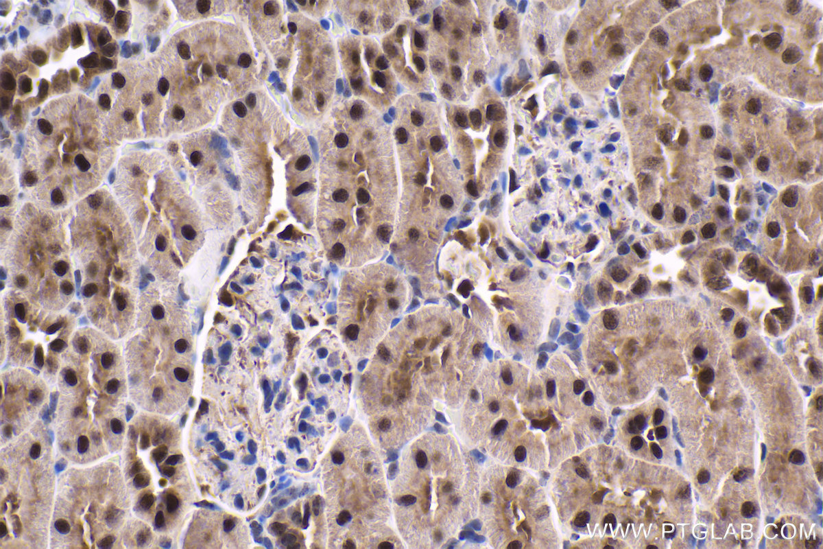 Immunohistochemical analysis of paraffin-embedded rat kidney tissue slide using KHC1651 (CSNK2A1 IHC Kit).