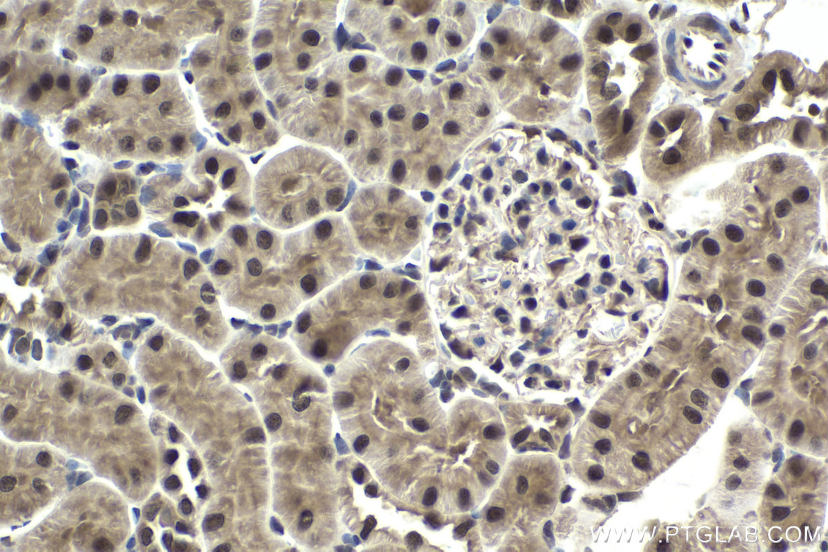 Immunohistochemical analysis of paraffin-embedded rat kidney tissue slide using KHC1650 (CSNK2B IHC Kit).